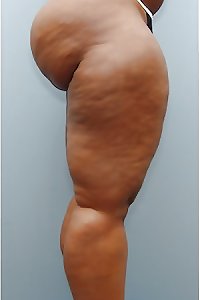 immense thighs Thights & Legs: witness The Thickness #22